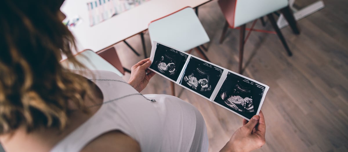 En gravid kvinna som håller upp en rad ultraljudsbilder